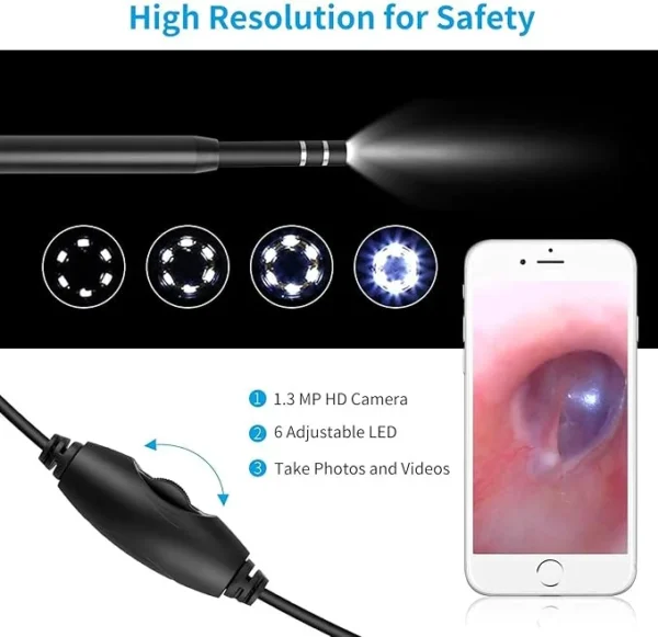 Otoscope